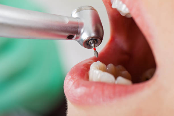 Best Emergency Dental Care for Trauma or Injury in Lavallette, NJ